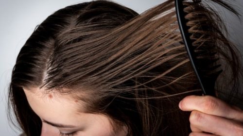 Oily scalp during winters follow the steps to get rid of the hair problem in winters