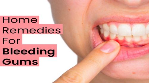Simple Home remedies which can help to cure Bleeding Gums